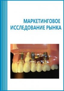 Анализ рынка стоматологических имплантатов в России