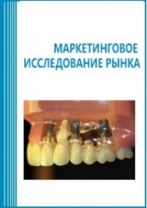 Анализ рынка стоматологических имплантов в России